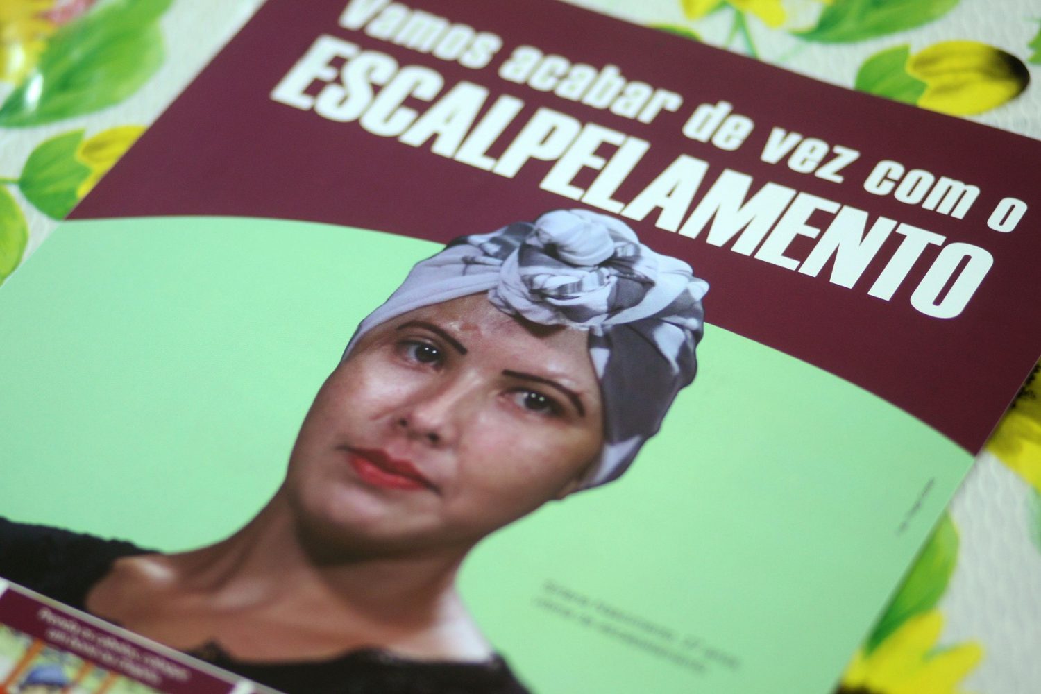 Foto Thiago Gomes/Agência Pará Em 2016, foram registrados seis acidentes por escalpelamento nos rios do Pará. Foto Thiago Gomes/Agência Pará