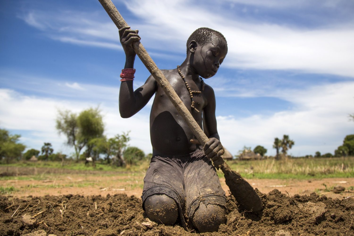 Foto Albert Gonzalez Farran/AFP O jovem Nyibol Lual, de 13 anos, ajuda a família a preparar a terra para a plantação. O Sudão do Sul, onde vivem, é um dos países mais afetados pela fome no mundo. Foto Albert Gonzalez Farran/AFP