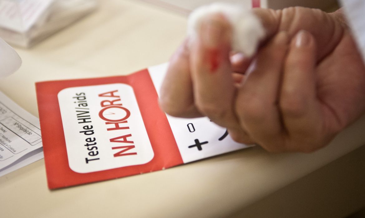 Pesquisadores afirmam que muitos serviços de testagem para Infecções Sexualmente Transmissíveis (ISTs), durante a pandemia, reduziram o horário de atendimento e o número de testagens (Foto: Marcelo Camargo/Agência Brasil)