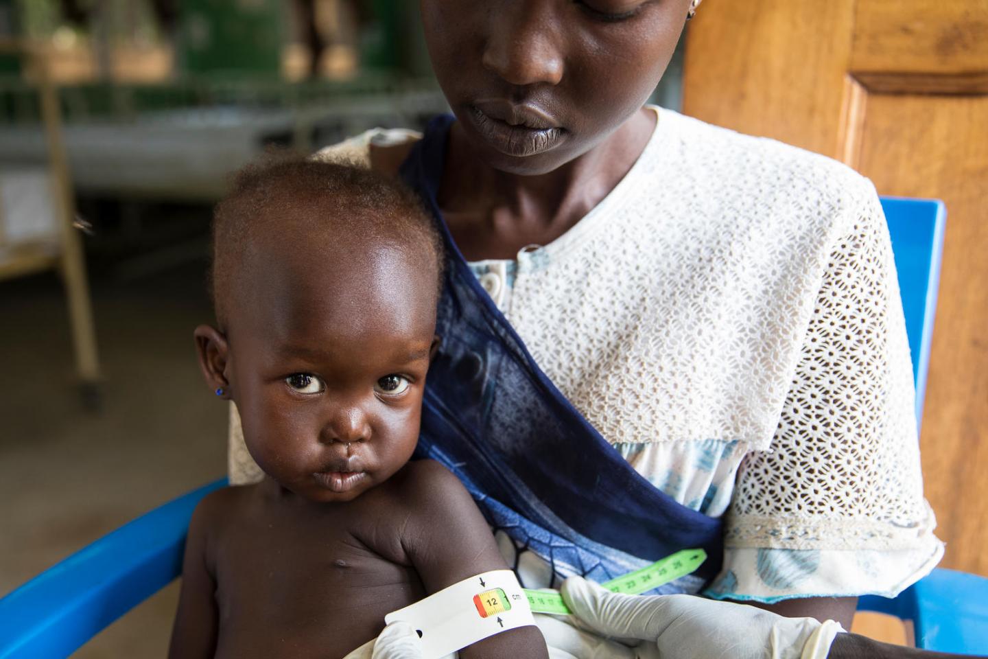 Criança, no colo da mãe, examinada por desnutrição em hospital do Sudão do Sul: fome atinge 800 milhões de pessoas (Foto: Unicef/Divulgação)