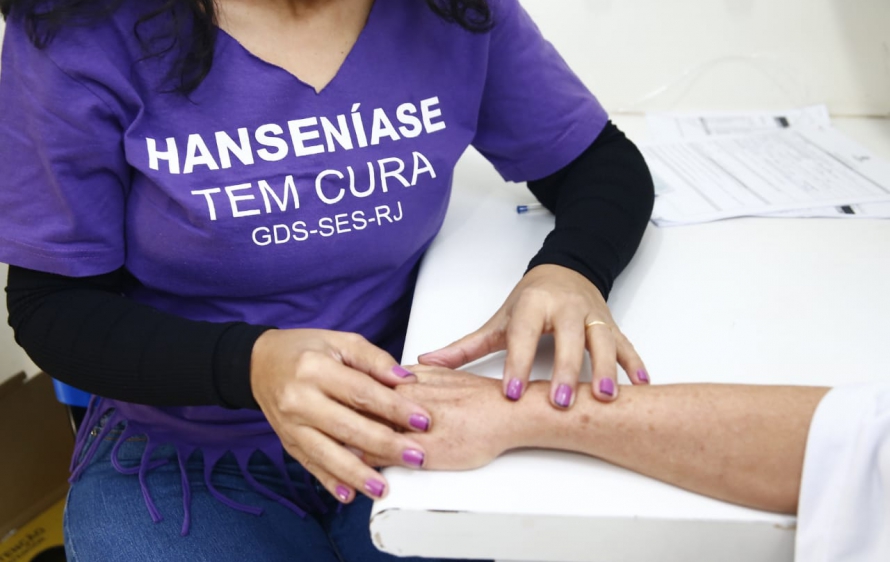 Exame para identificar hanseníase: apesar do preconceito, doença tem cura e pode não ter sequelas com diagnóstico precoce (Foto: SES/RJ - 04/05/2019)