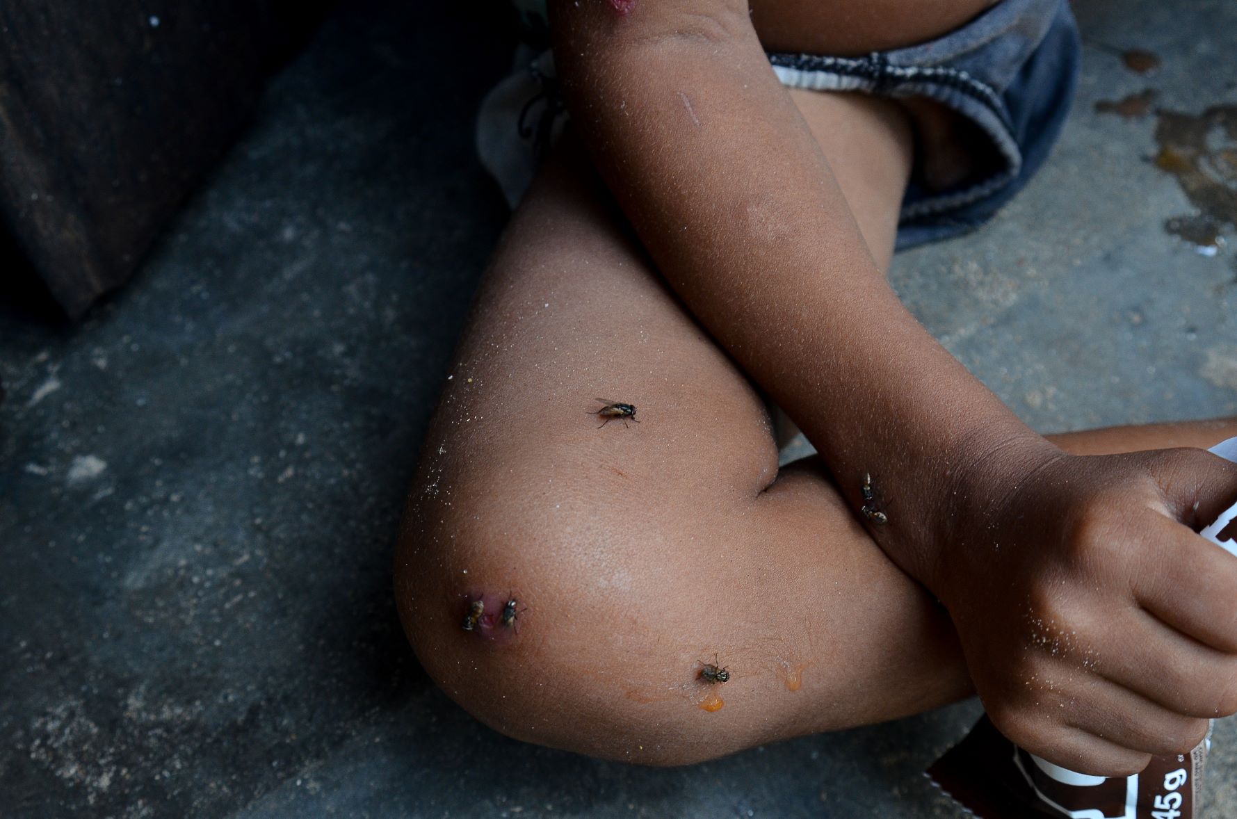 Mateus, criança doente, em condições sub humanas e ambiente insalubre: miséria e violência em município cearense conhecido por belas praias (Foto: João Paulo Guimarães)